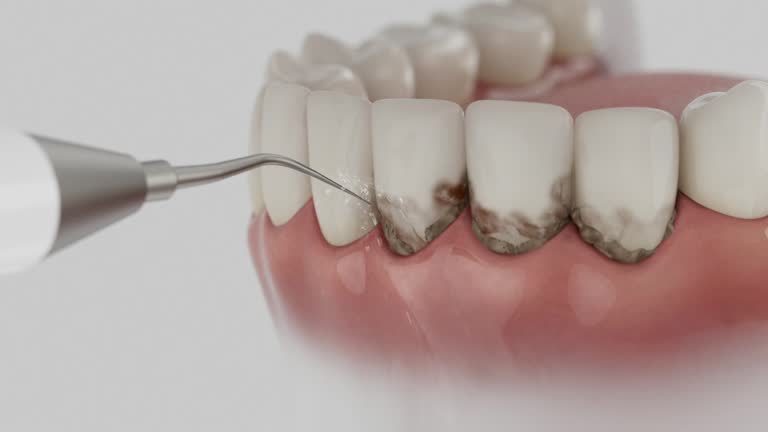 Reliable Dental contractor in Summerfield, MD by Dentist Open Now